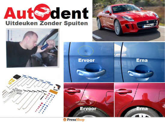 Autodent